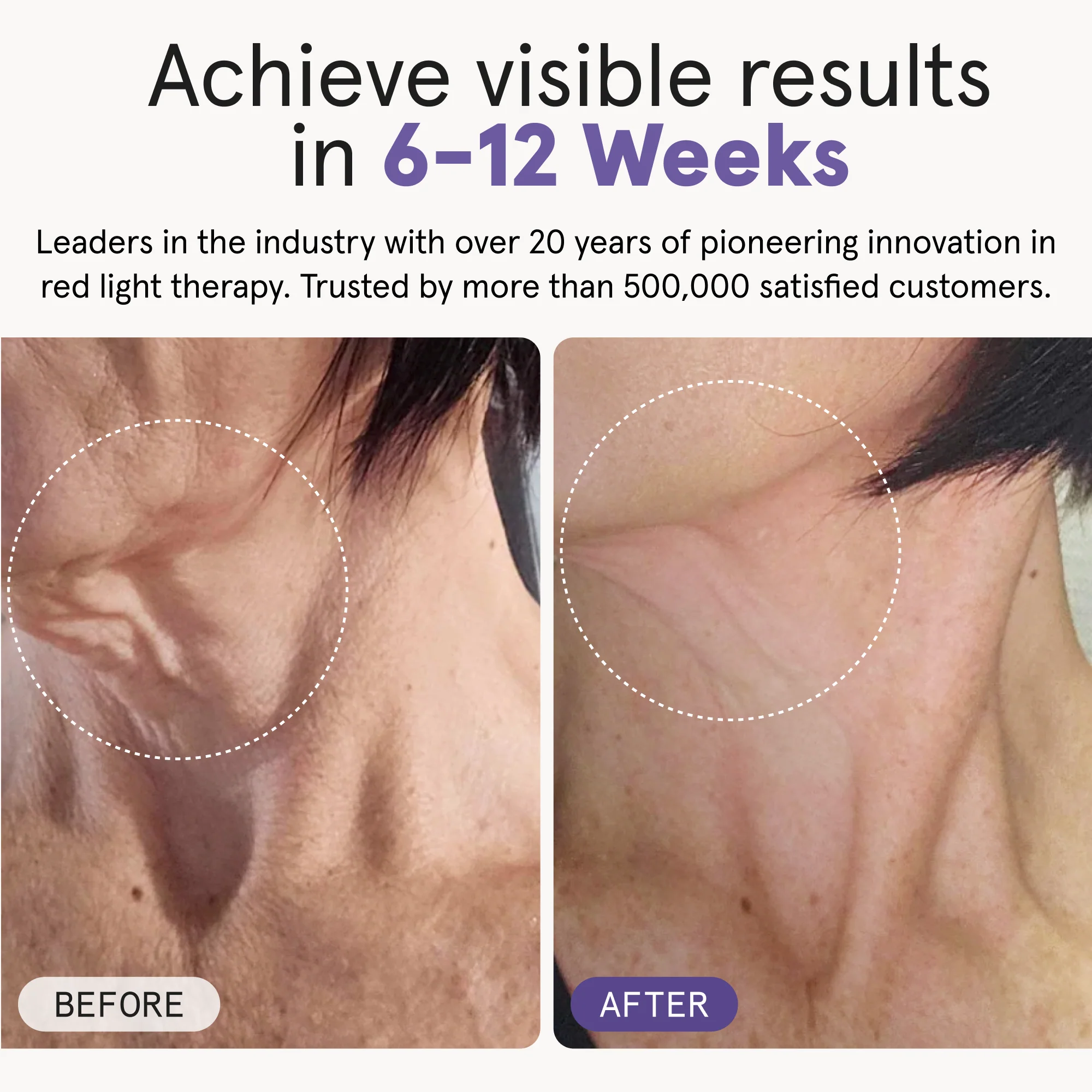 Illumina Neck & Chest Mask - Image 7